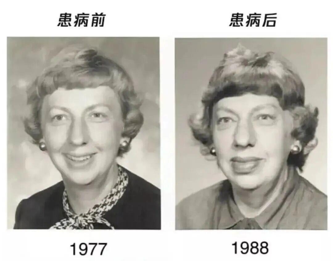 这种面相可能是肿瘤前兆!别以为只是“发福”了(图2)