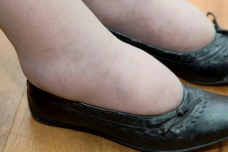 这种面相可能是肿瘤前兆!别以为只是“发福”了(图4)